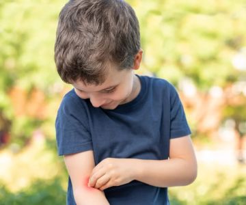 How to Avoid Insect Bites While Camping: Smart Prevention Tips