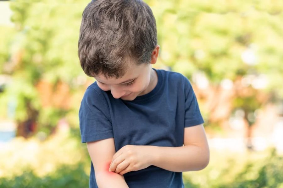 How to Avoid Insect Bites While Camping: Smart Prevention Tips