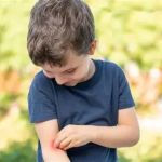 How to Avoid Insect Bites While Camping | Expert Tips and Solutions